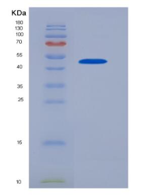 Recombinant Bcl2/Adenovirus E1B 19kDa Interacting Protein 3 (BNIP3)