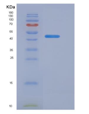 Recombinant Human Aquaporin 4 (AQP4) Protein