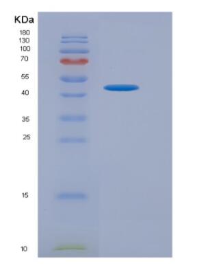 Recombinant Human Gamma-Aminobutyric Acid B Receptor 1 (gABBR1) Protein