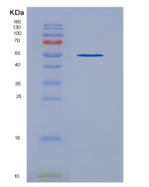 Recombinant Human TIE2 protein