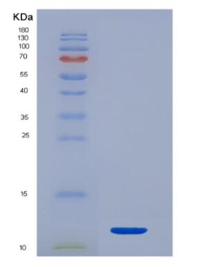 Recombinant Human Procalcitonin (PCT) protein