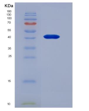 Recombinant Mouse Retnlb protein