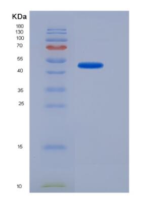 Recombinant Human Ubiquitin Specific Peptidase 7 (USP7) Protein