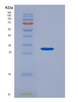 Recombinant Human Cyclooxygenase 1 (COX-1)