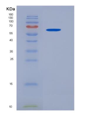 Recombinant Human Telomerase Reverse Transcriptase (TERT)