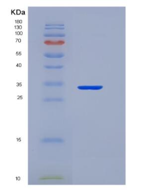 Recombinant TNF Receptor Associated Factor 6 (TRAF6)