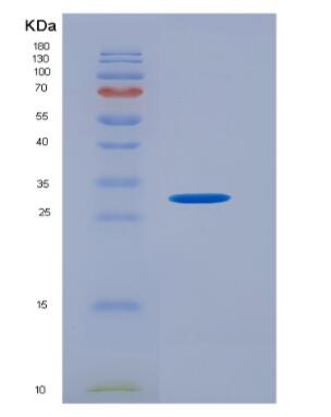 Recombinant Neutrophil Elastase (NE)