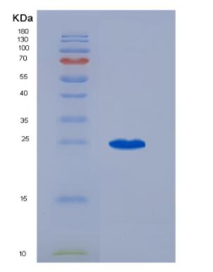 Recombinant Thrombospondin 1 (THBS1)