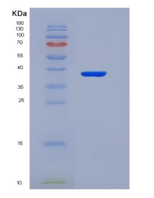 Recombinant Serotonin Transporter (SERT)