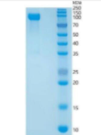 Recombinant Galactosidase Beta (GLb) Protein