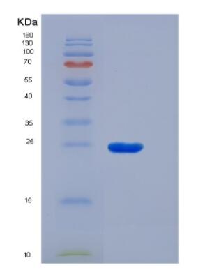 Recombinant Human Solute Carrier Family 30 Member 8 (SLC30A8) protein