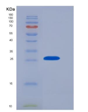 Recombinant Mouse Galectin3(GAL3)protein