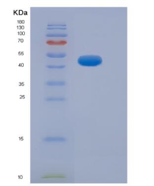 Recombinant Human Neurofilament, Heavy Polypeptide (NEFH)