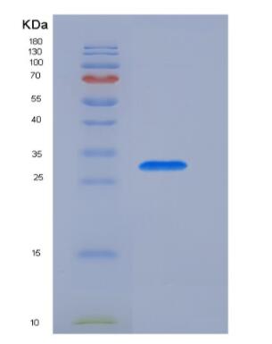 Recombinant Pulmonary Surfactant Associated Protein A1 (SFTPA1)