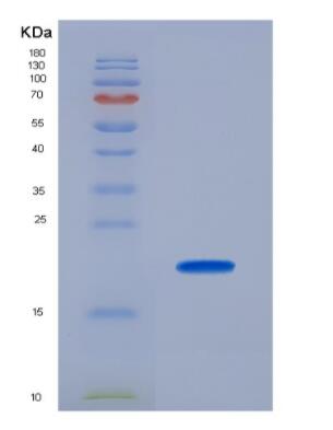 Recombinant Cytochrome C Oxidase Subunit II (COX2)