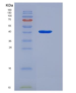 Recombinant Human Rhodopsin (RHO) Protein