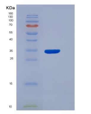 Recombinant Human Aryl Hydrocarbon Receptor (AhR) Protein