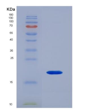 Recombinant Human SFTPD Protein