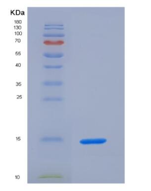 Recombinant S100 Calcium Binding Protein A9 (S100A9)