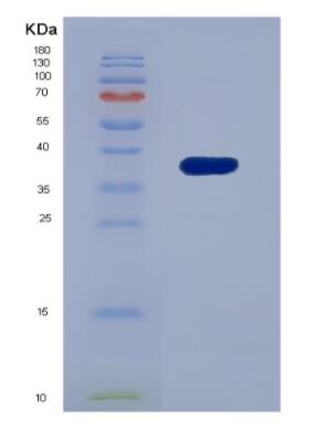 Recombinant Interferon Inducible Protein 35 (IFI35)