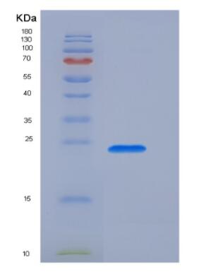 Recombinant Human Transient Receptor Potential Cation Channel Subfamily V, Member 1 (TRPV1) Protein