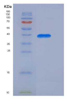 Recombinant Insulin (INS) protein