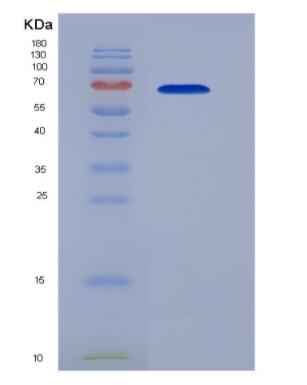 Recombinant Mouse Heat Shock 70kDa Protein 1B (HSPA1B)