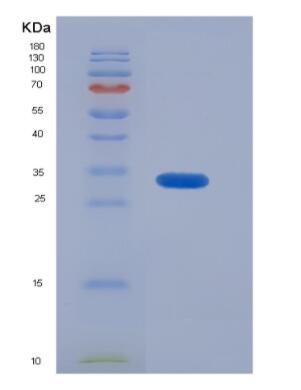 Recombinant Human Calcitonin (CT) protein