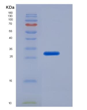 Recombinant Human Beta Actin (ACTB) Protein