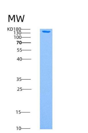 Recombinant Human AMPK (G1/B1/A2) Heterotrimer Protein