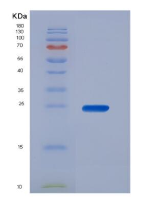 Recombinant Carcinoembryonic Antigen (CEA)