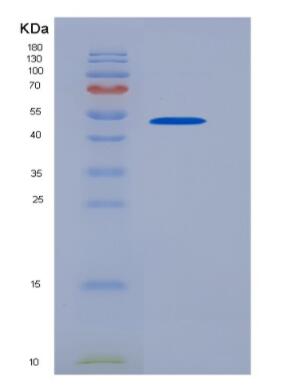 Recombinant Human CD83 protein