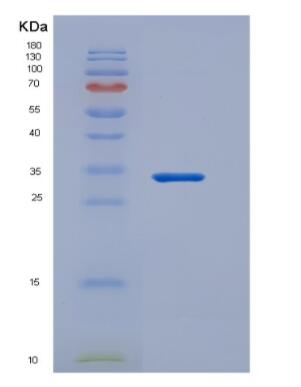 Recombinant Rat TNFRSF17 / BCMA Protein (Fc tag)