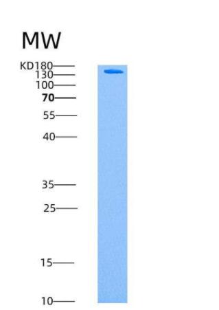 Recombinant Human AMPK (G1/B2/A1) Heterotrimer Protein