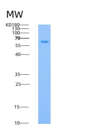 Recombinant Mouse Endoglin / CD105 / ENG Protein (His tag)