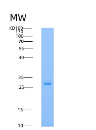 Recombinant Human respiratory syncytial virus (RSV) (A, rsb1734) glycoprotein G / RSV-G Protein (93% Homology) (His Tag)