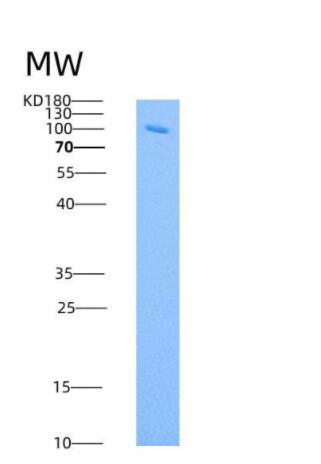 Recombinant Human ANPEP / CD13 Protein (603 Met/Ile, His tag)