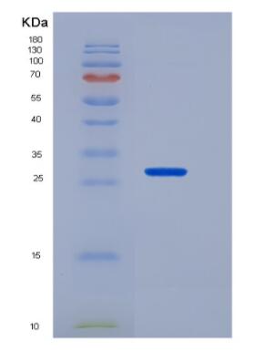 Recombinant Tumor Necrosis Factor Receptor Superfamily, Member 17 (TNFRSF17)