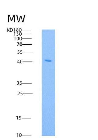 Recombinant Human RRM2B / P53R2 Protein (His tag)