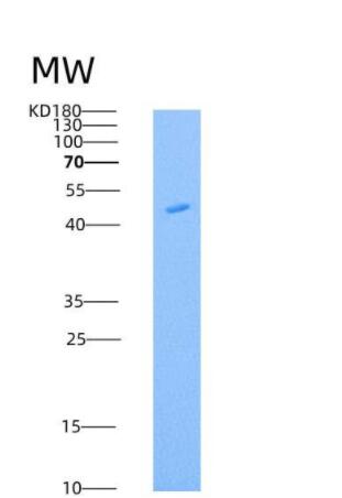 Recombinant Mouse Legumain Protein (His Tag)