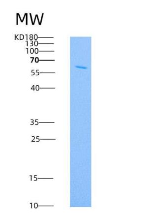 Recombinant Human IL18RAP / IL1R7 Protein (Fc tag)