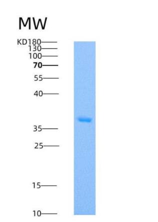 Recombinant Human PTP1B / PTPN1 Protein (His Tag)