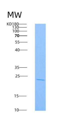 Recombinant Human RhoA Protein (His tag)