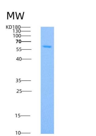 Recombinant Human SMPD1 / ASM Protein (His tag)