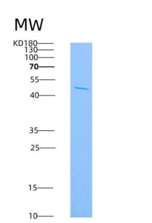 Recombinant Rat IL4R / Il4ra Protein (Fc tag)