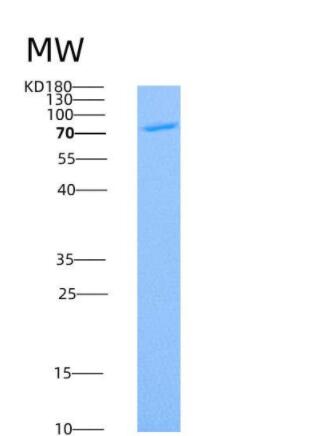 Recombinant Mouse ADAM9 Protein (His tag)