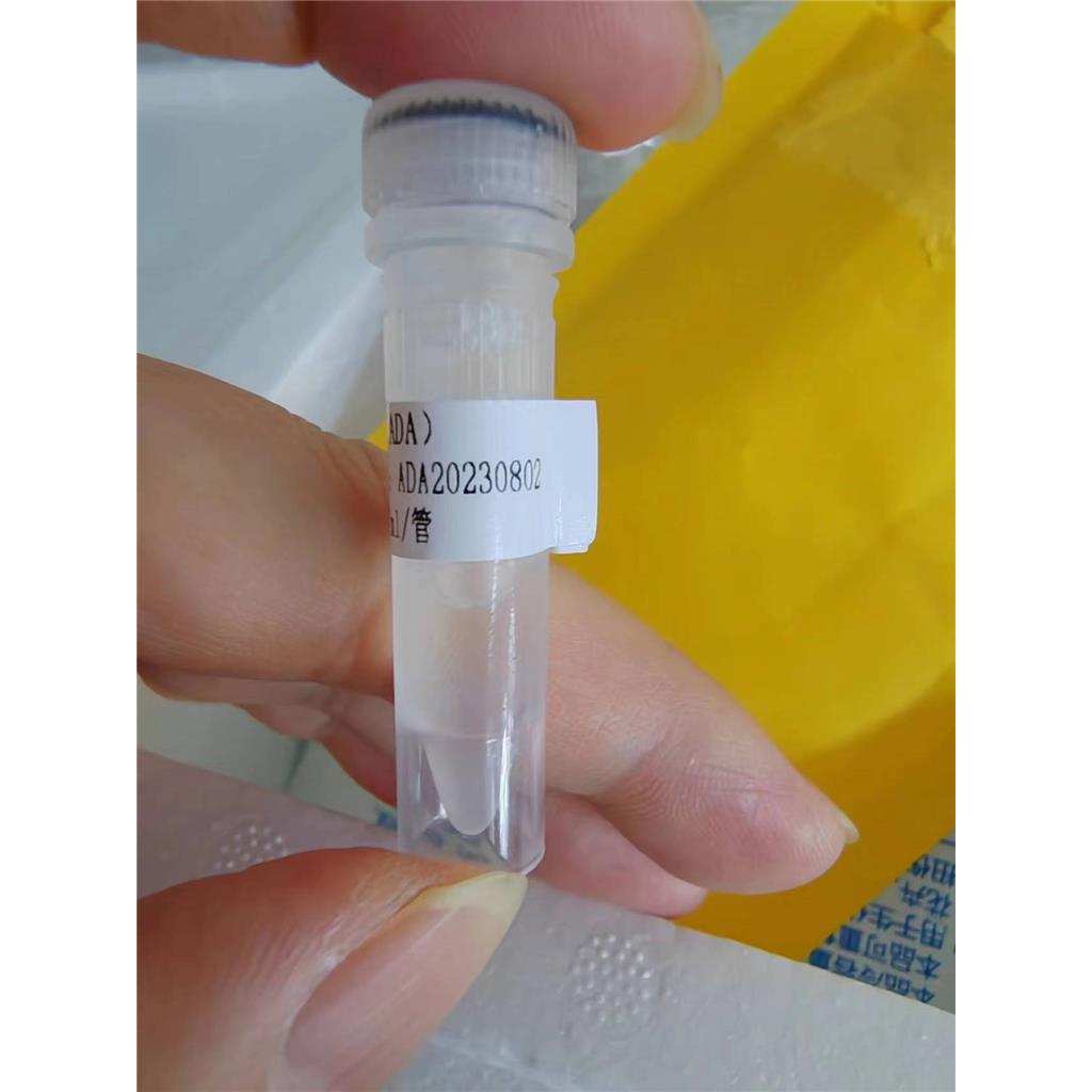 腺苷脱氨酶 (ADA) 液体  冻干粉