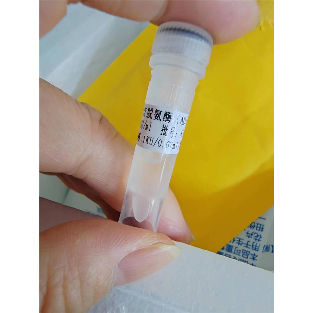 腺苷脱氨酶 (ADA) 液体  冻干粉