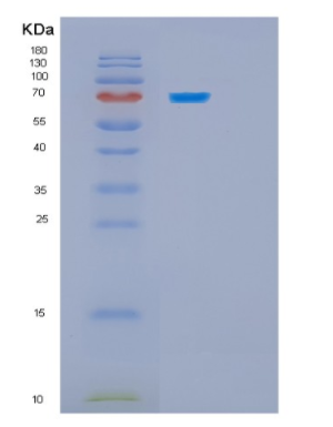 Recombinant Human HSPA5 Protein