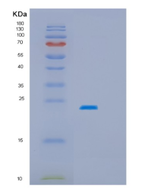 Recombinant Human HSPB2 Protein